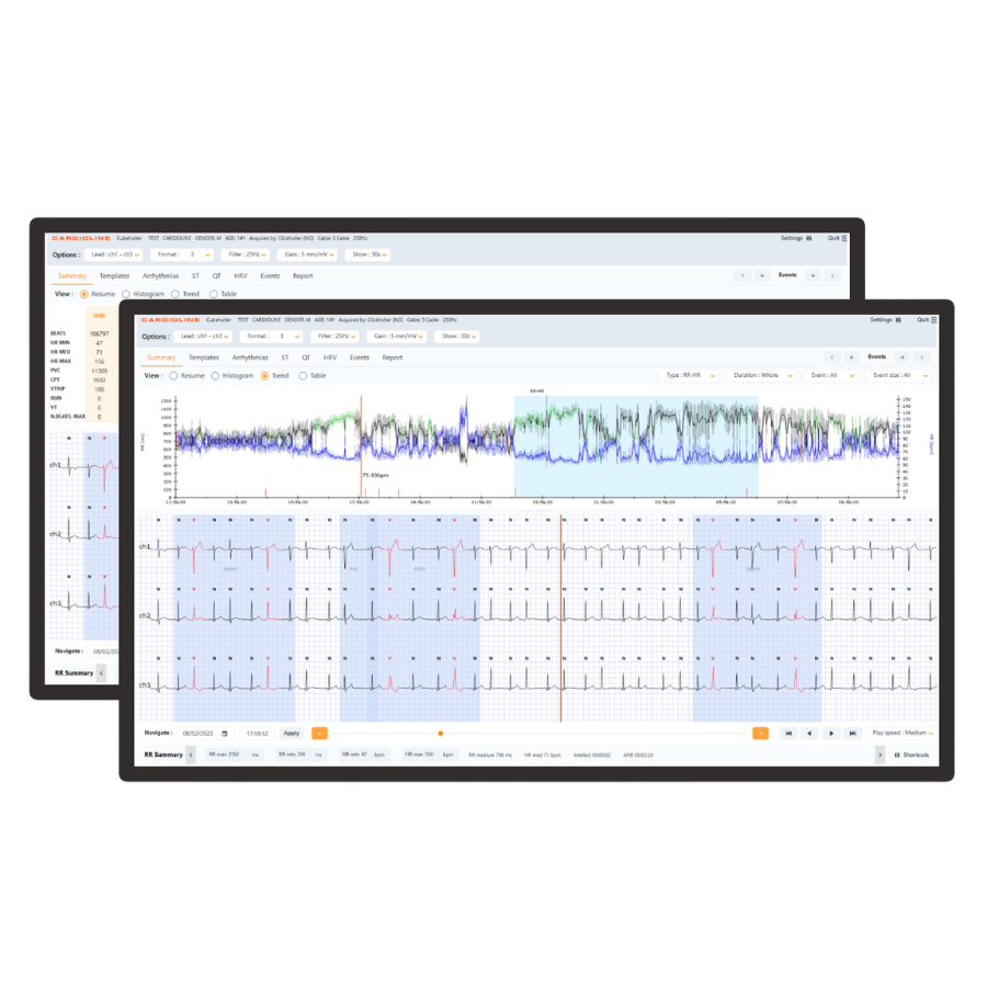 Aplicación web de ECG Holter